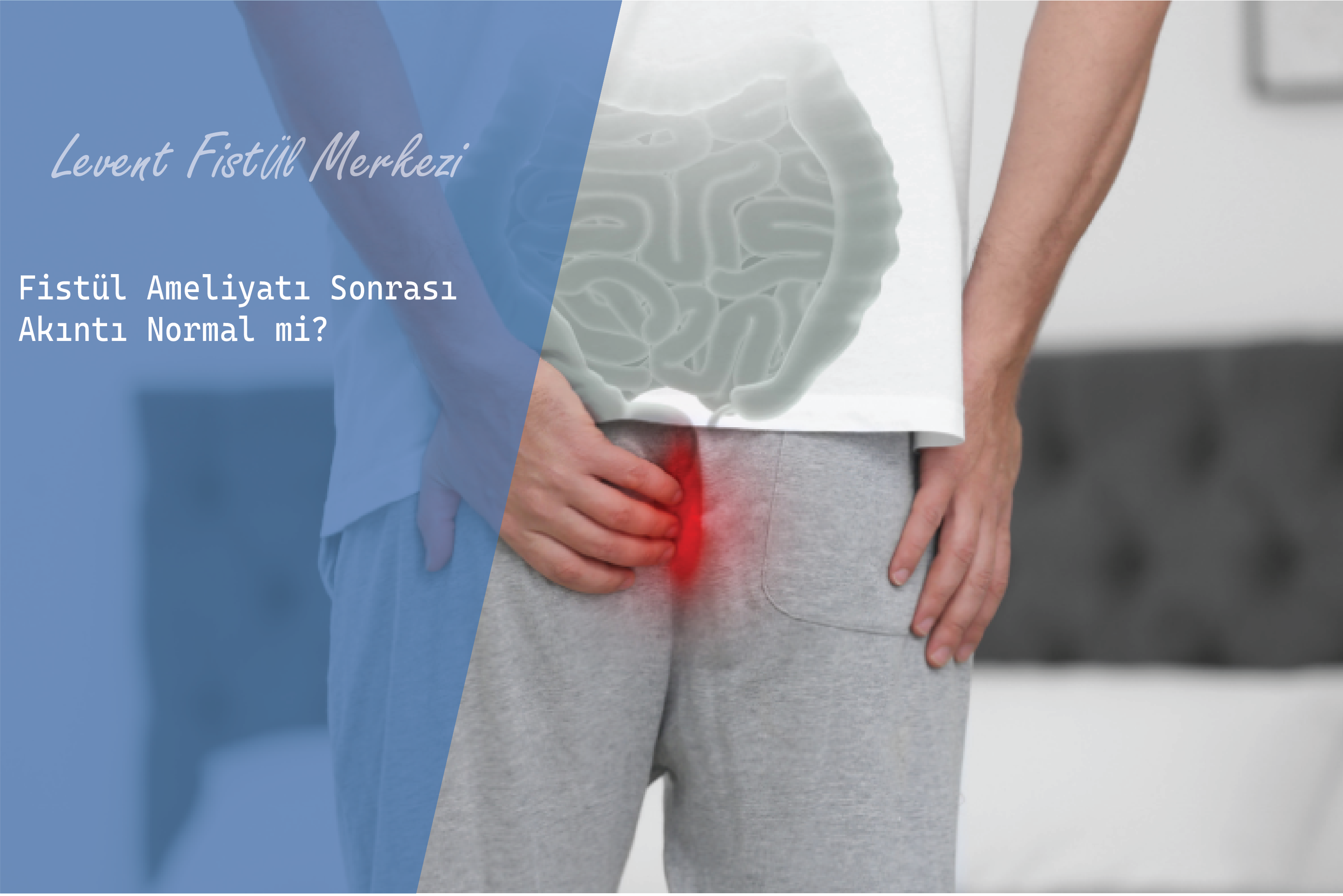 Fistül Ameliyatı Sonrası Akıntı Normal mi?